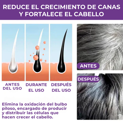Champú para canas ShampoMax® - COMPRE 1 LLÉVESE 2 GRATIS CON 2 REGALOS SORPRESA