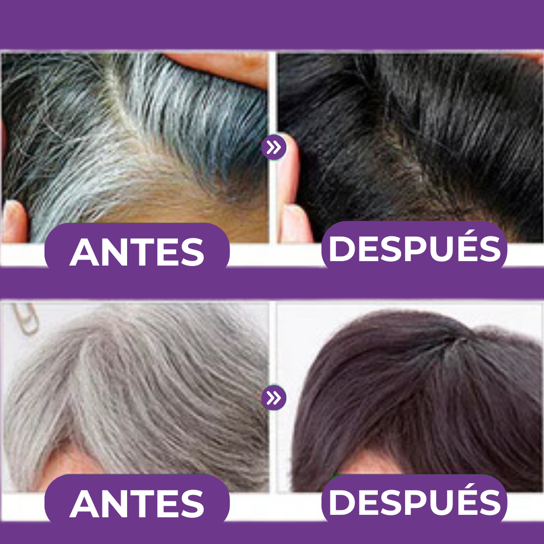 Champú para canas ShampoMax® - COMPRE 1 LLÉVESE 2 GRATIS CON 2 REGALOS SORPRESA