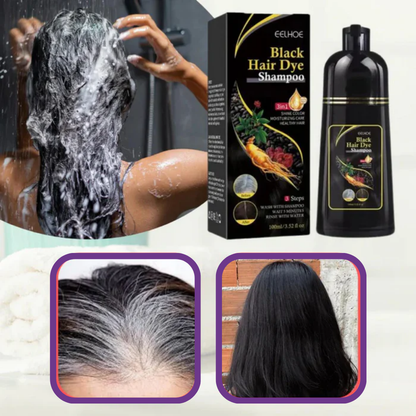 Champú para canas ShampoMax® - COMPRE 1 LLÉVESE 2 GRATIS CON 2 REGALOS SORPRESA